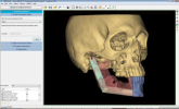 Materialise-ProPlan-CMF.SC_.png Materialise-ProPlan-CMF.SC_.png