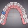Autolign 3D