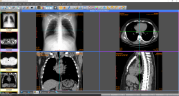 Sante DICOM Viewer Pro