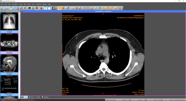 sante_dicom_viewer_lite.png