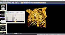 Sante DICOM Viewer Pro