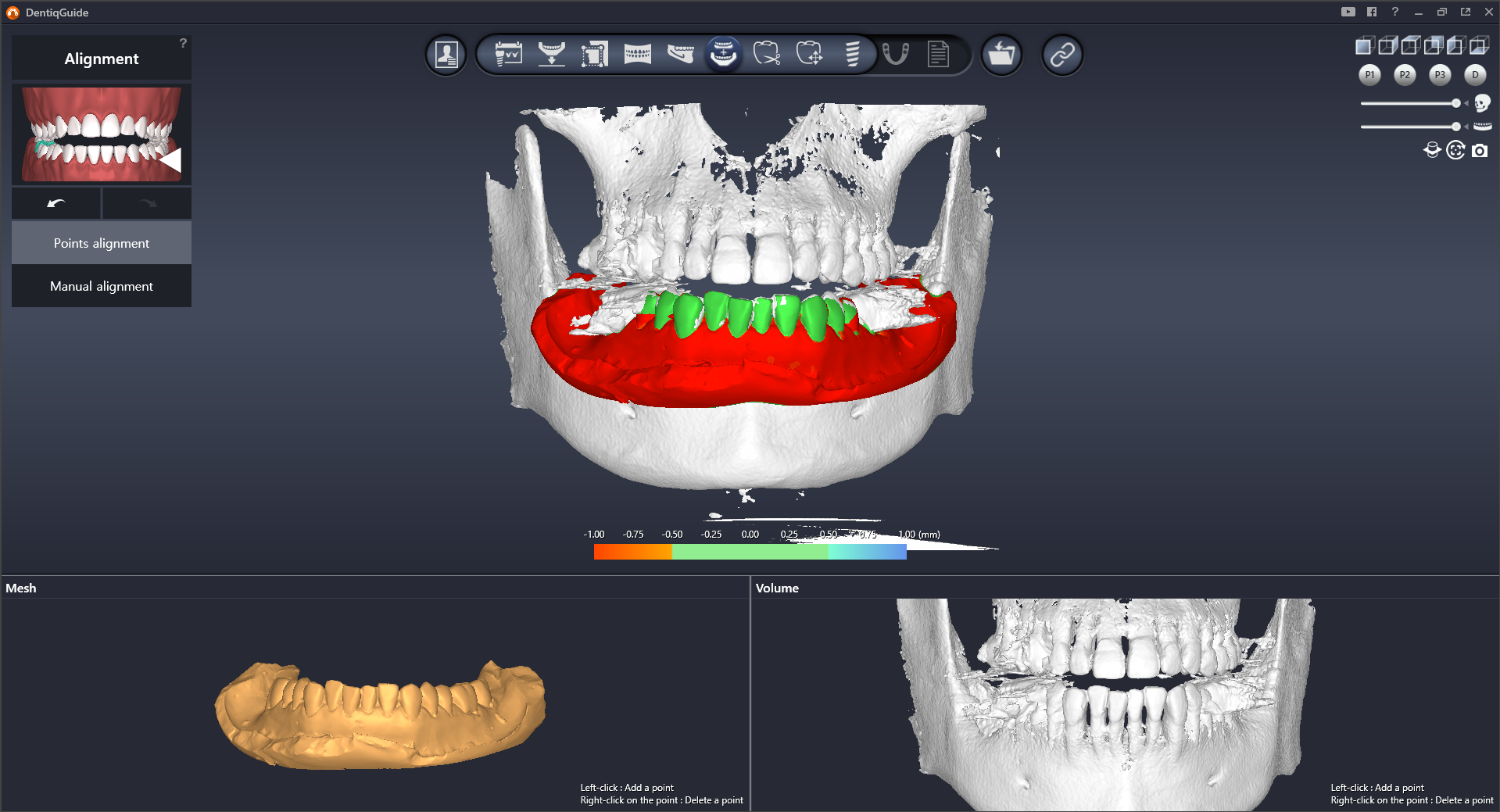 Выравнивание данных КТ-сканирования
