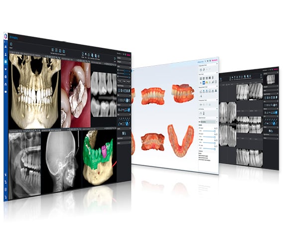 romexis-all-in-one-dental-software.jpg