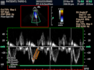 Sante DICOM Viewer Pro