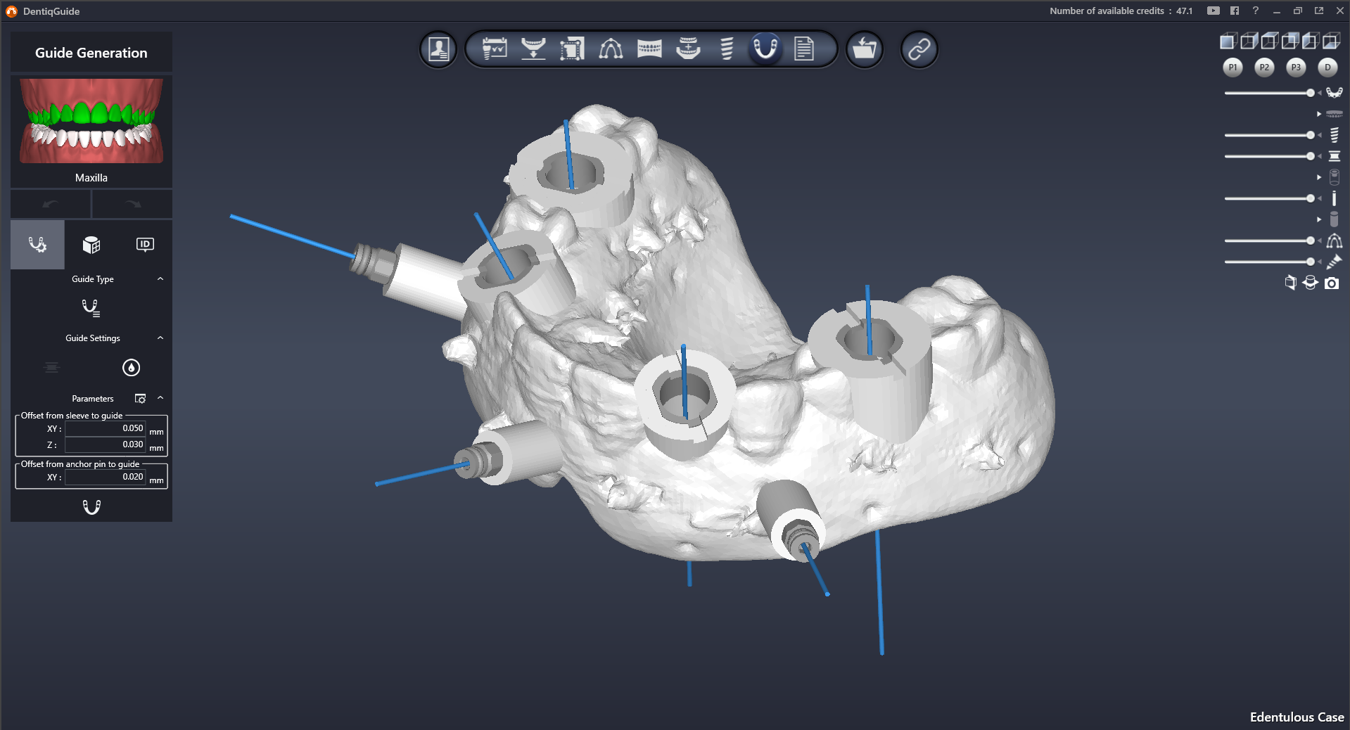 Интерфейс DentiqGuide 2