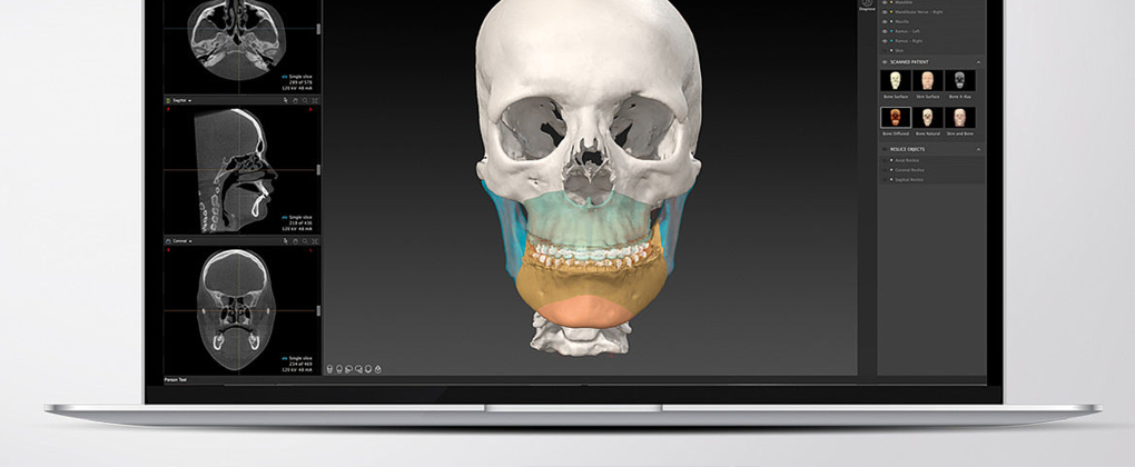 IPS CaseDesigner®