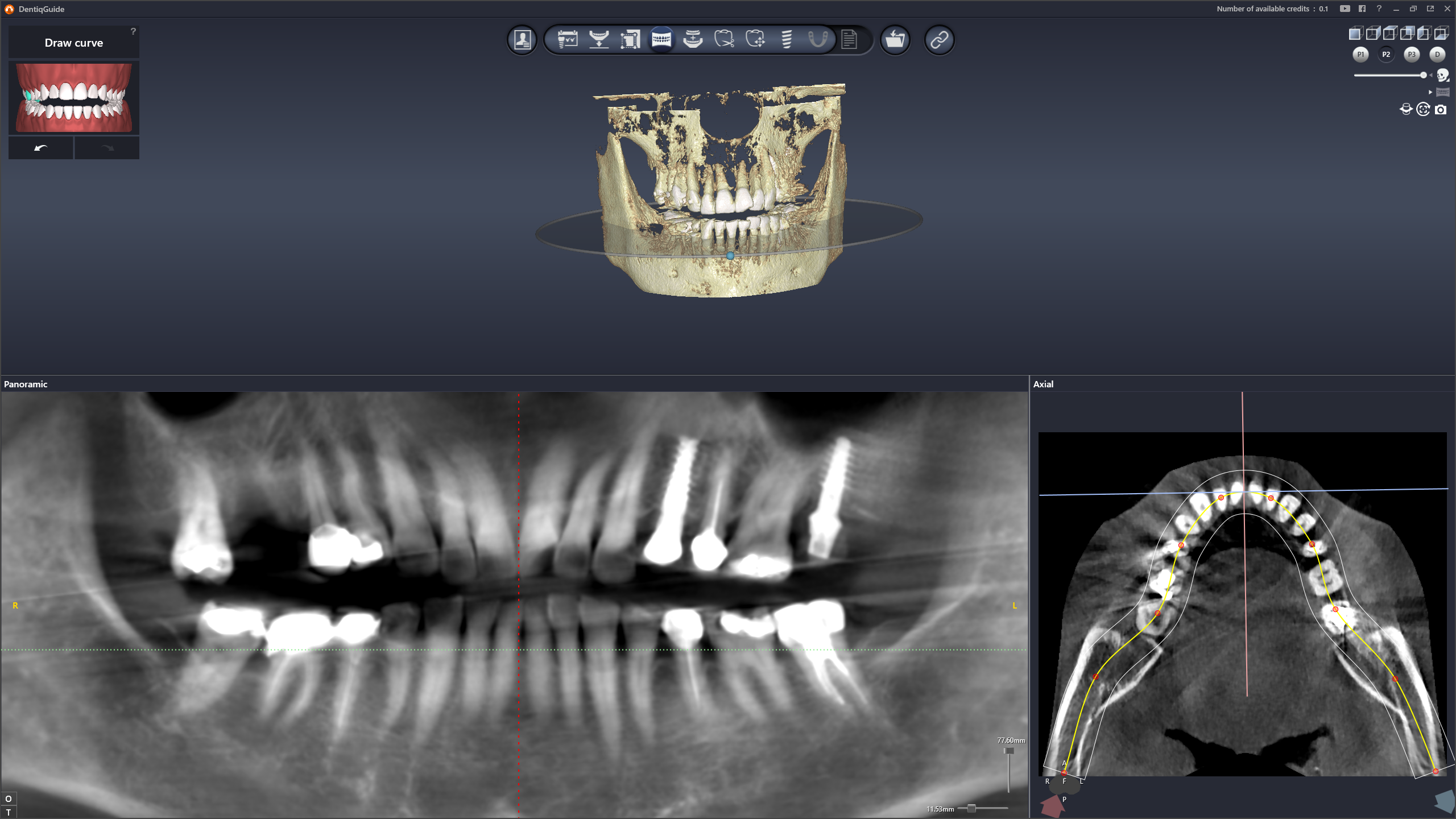 Панорамная реконструкция