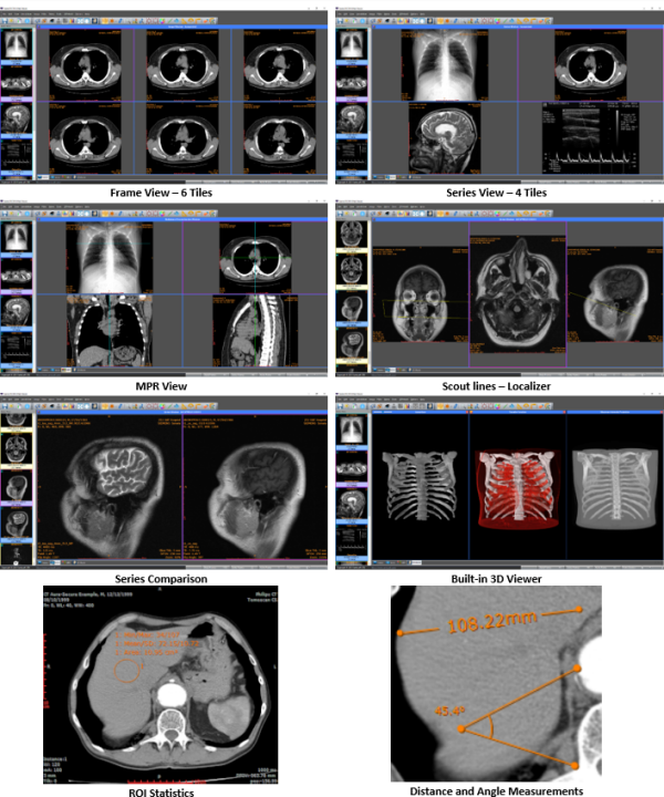 sante_dicom_viewer_lite_2.png