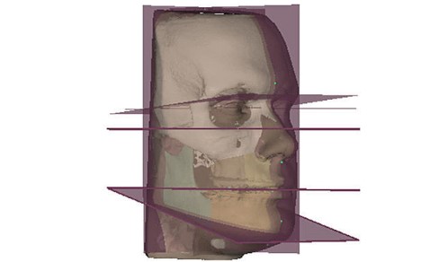 Диагностический инструмент Surgery Ceph Wizard