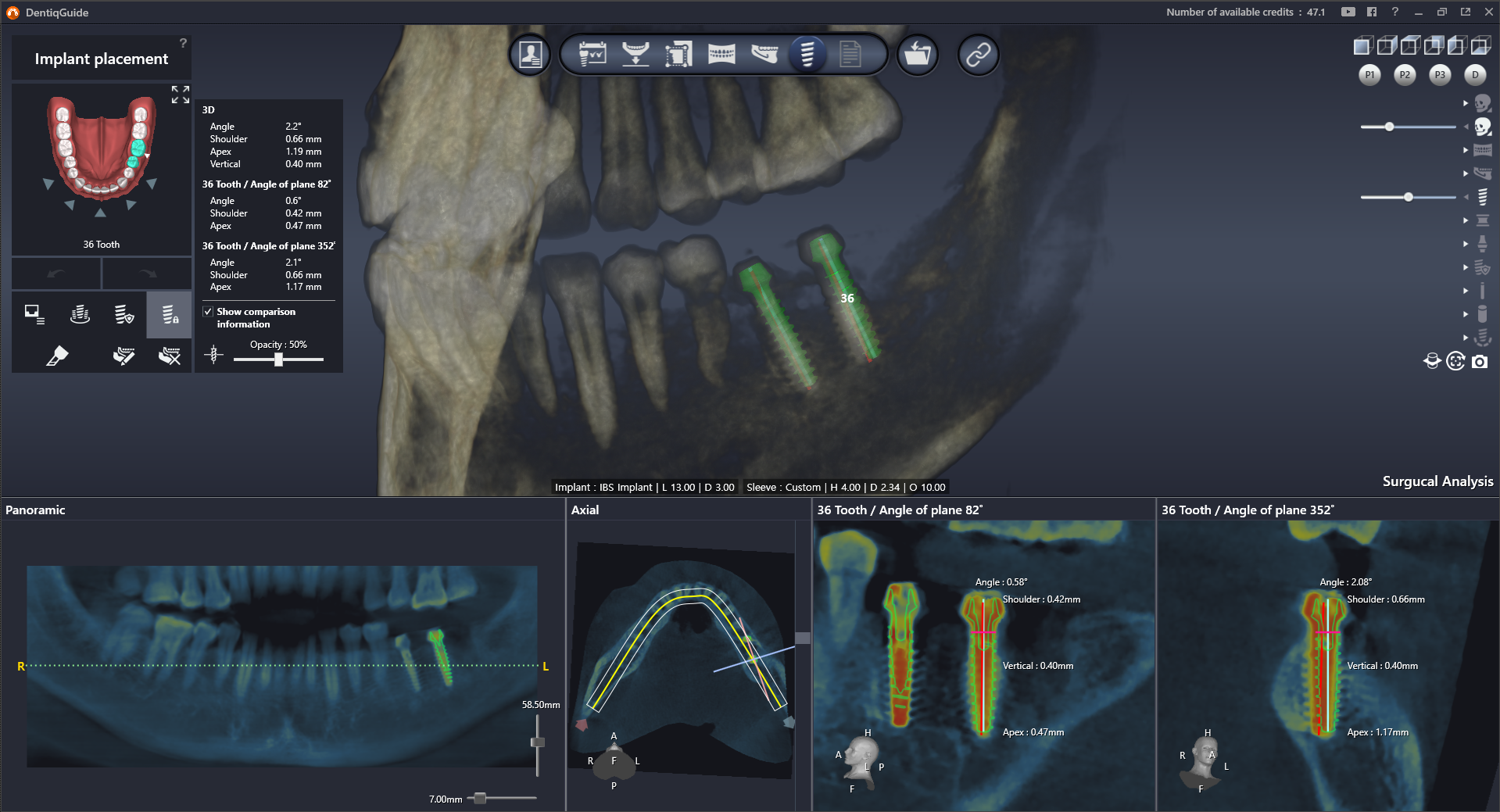 Интерфейс DentiqGuide 4