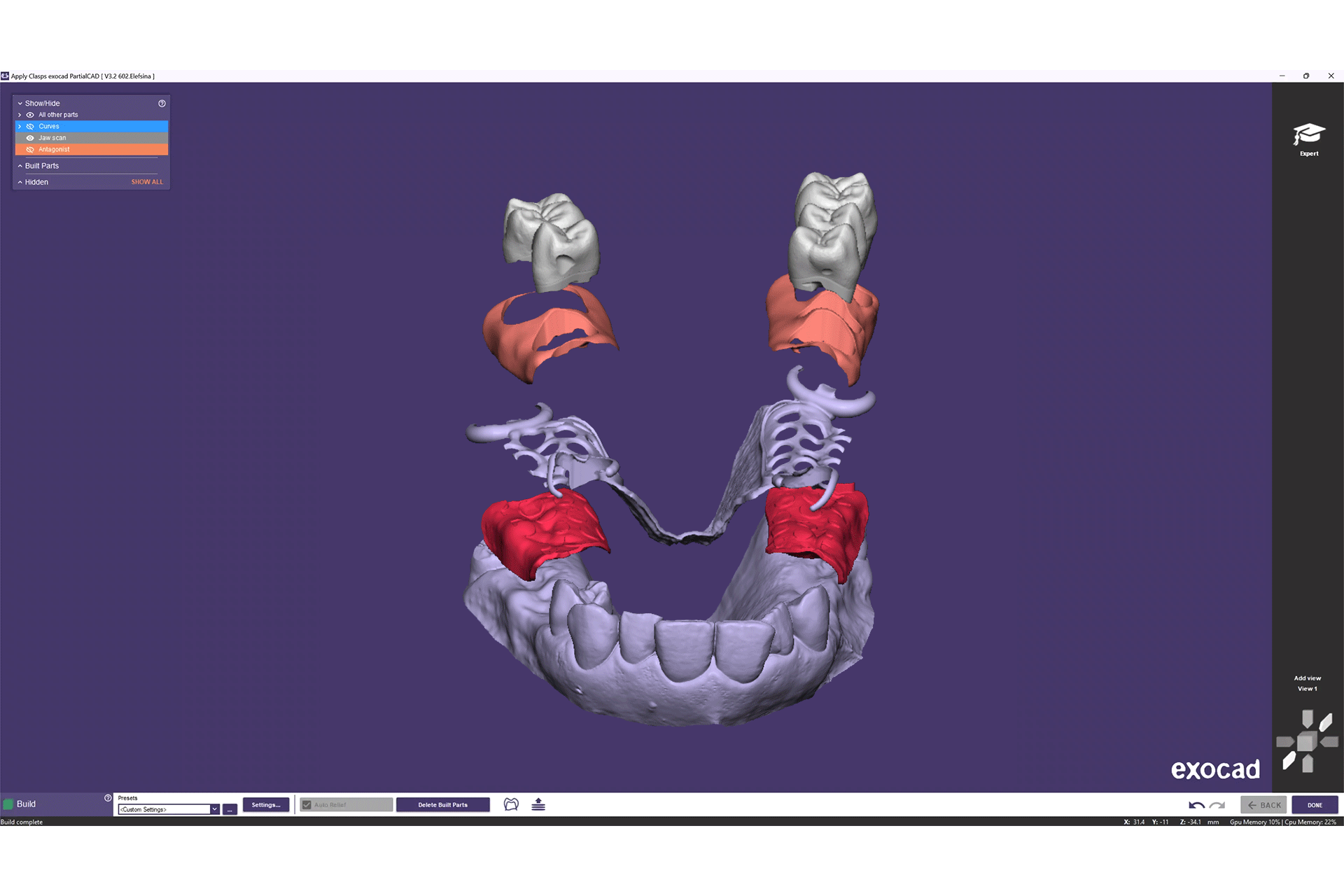 exocad_PartialCAD_Elefsina_Exploded_With_Gingiva_Feature_01_02.gif