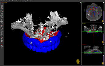 Технология двойного сканирования Технология двойного сканирования