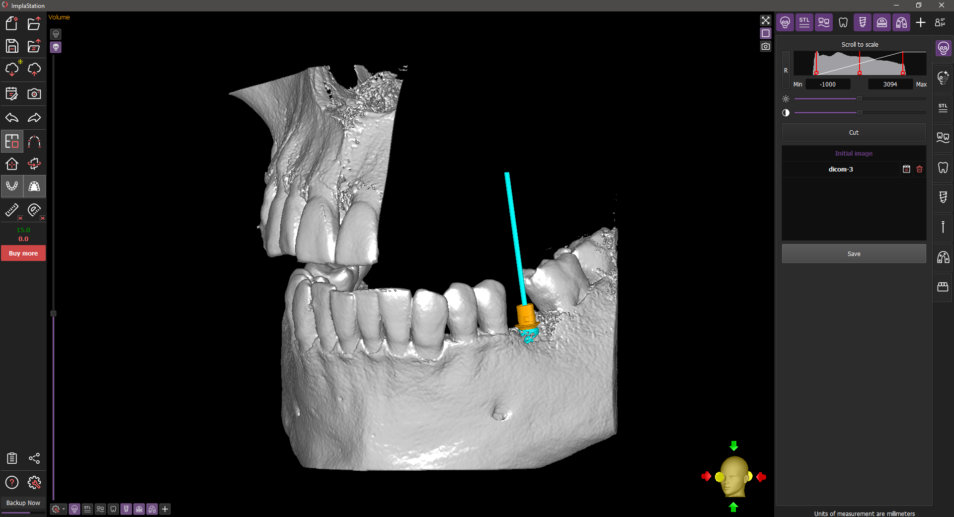 DICOM-резка DICOM-резка