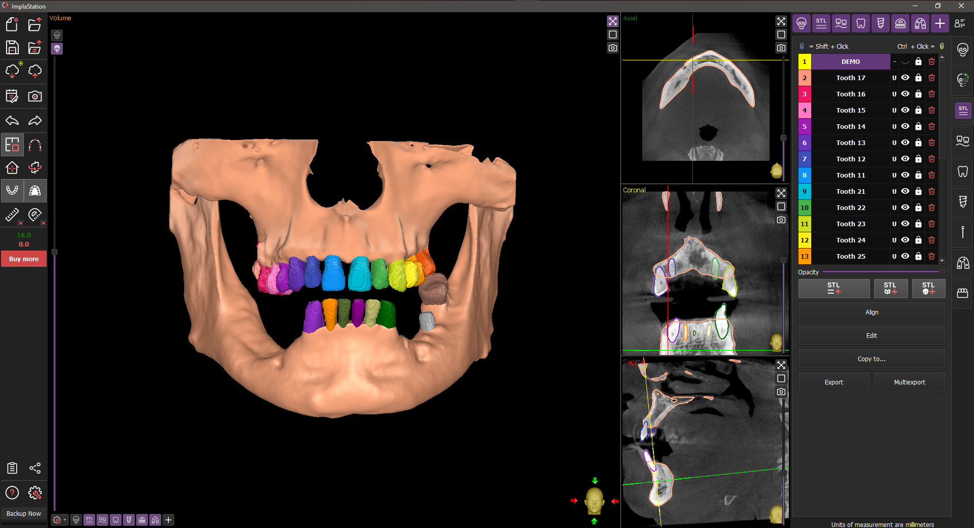Сегментация Сегментация