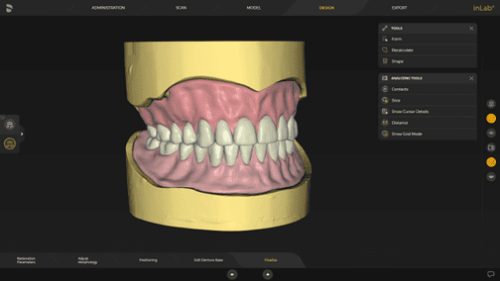 lab-image-screen-inlab-sw-22-digital-denture-09.png