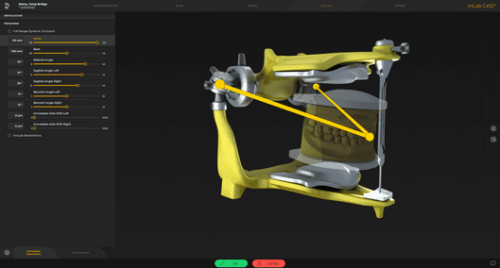 lab-image-screen-inlab-sw-22-virtual-articulator.png