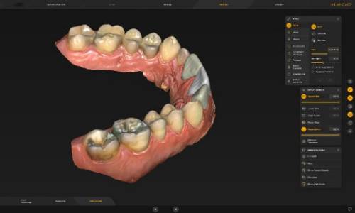 lab-image-inlab-cad-sw-screen-570x342.jpeg