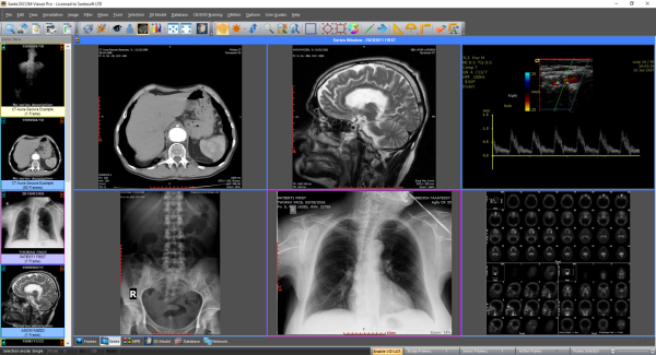 dicom_viewer_1.png